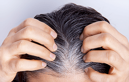 発毛を促進する有効成分